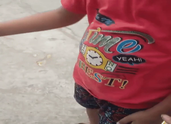 कानपुर में पड़ोसी की बर्बरता: अमरूद गिरने पर 7 साल के बच्चे को कुत्ते से कटवाया